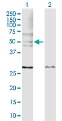 Western Blot: N-WASP Antibody [H00008976-D01P]