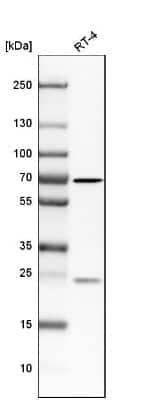 Western Blot: N-WASP Antibody [NBP1-82512]