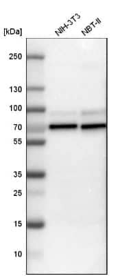 Western Blot: N-WASP Antibody [NBP1-82512]
