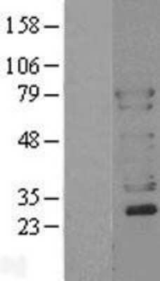 Western Blot: N-WASP Overexpression Lysate [NBL1-17778]