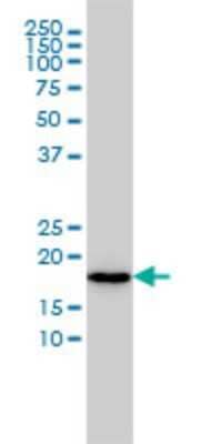 Western Blot: N acetyl transferase 5 Antibody (2C6) [H00051126-M01]