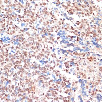 Immunohistochemistry-Paraffin: N acetyl transferase 5 Antibody - Azide and BSA Free [NBP2-94531]