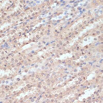 Immunohistochemistry-Paraffin: N acetyl transferase 5 Antibody - Azide and BSA Free [NBP2-94531]