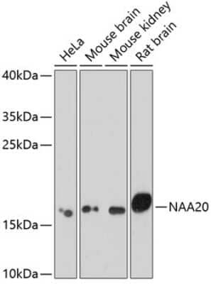 Western Blot: N acetyl transferase 5 AntibodyAzide and BSA Free [NBP2-94531]