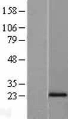 Western Blot: N acetyl transferase 5 Overexpression Lysate [NBL1-13489]