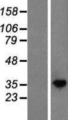 Western Blot: N-Acetyl-D-Glucosamine Kinase/NAGK Overexpression Lysate [NBP2-06964]