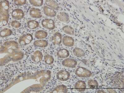 Immunohistochemistry-Paraffin: N myc interactor Antibody (9B8) [H00009111-M03]