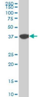 Western Blot: N myc interactor Antibody (9B8) [H00009111-M03]