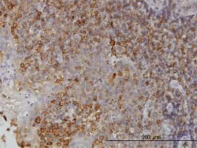 Immunohistochemistry-Paraffin: N myc interactor Antibody (9D8) [H00009111-M01]