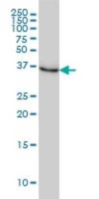 Western Blot: N myc interactor Antibody (9D8) [H00009111-M01]