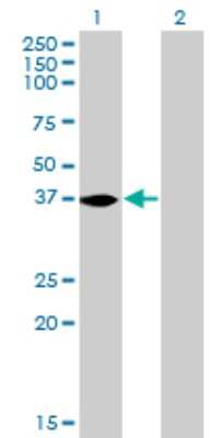 Western Blot: N myc interactor Antibody (9D8) [H00009111-M01]
