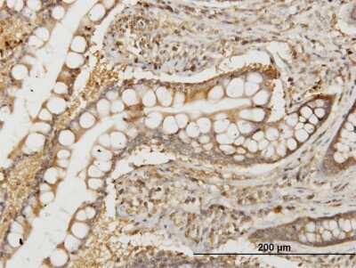 Immunohistochemistry-Paraffin: N myc interactor Antibody (9E8) [H00009111-M04]