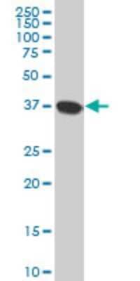 Western Blot: N myc interactor Antibody (9E8) [H00009111-M04]