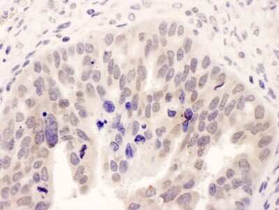 Immunohistochemistry: N myc interactor Antibody [NB100-763]