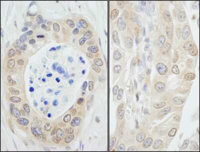 Immunohistochemistry: N myc interactor Antibody [NB100-764]