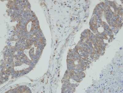 Immunohistochemistry-Paraffin: N myc interactor Antibody [NBP1-31424]