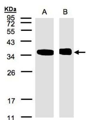 Western Blot: N myc interactor Antibody [NBP1-31424]