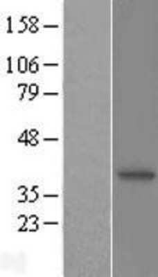 Western Blot: N myc interactor Overexpression Lysate [NBL1-13690]