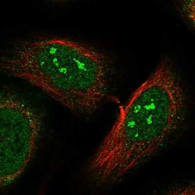 Immunocytochemistry/ Immunofluorescence: N4BP1 Antibody [NBP1-86238]