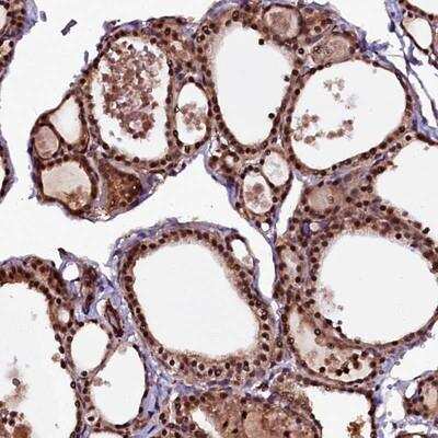 Immunohistochemistry-Paraffin: N4BP1 Antibody [NBP1-86233]