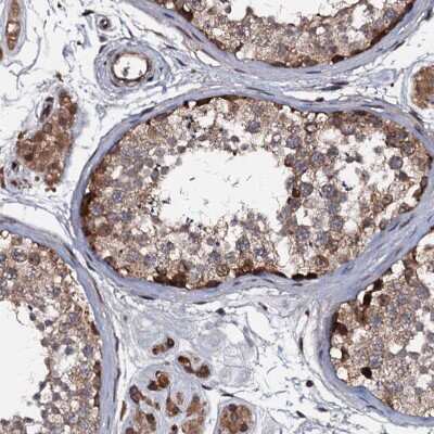 Immunohistochemistry-Paraffin: N4BP1 Antibody [NBP1-86238]