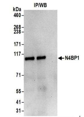 Immunoprecipitation: N4BP1 Antibody [NBP2-37688]