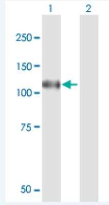 Western Blot: N4BP1 Antibody [H00009683-B01P-50ug]