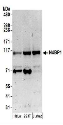 Western Blot: N4BP1 Antibody [NBP2-37688]