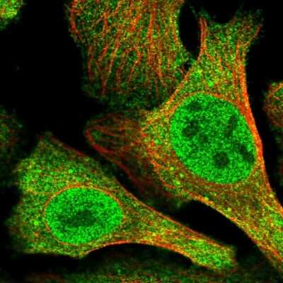 Immunocytochemistry/ Immunofluorescence: N4BP2 Antibody [NBP2-59017]