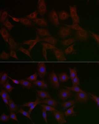 Immunocytochemistry/ Immunofluorescence: N4BP2 Antibody - Azide and BSA Free [NBP3-16022]