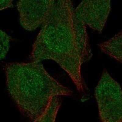 Immunocytochemistry/ Immunofluorescence: N4BP2 Antibody [NBP3-17277]