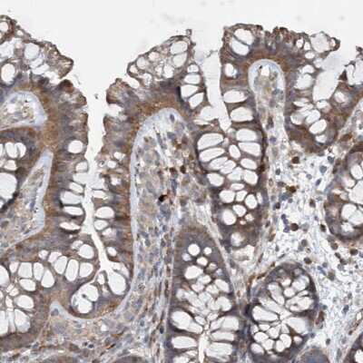 Immunohistochemistry-Paraffin: N4BP2 Antibody [NBP1-88948]
