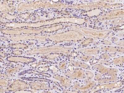 Immunohistochemistry-Paraffin: N4BP2 Antibody [NBP2-98059]