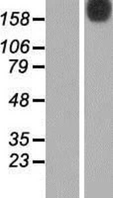 Western Blot: N4BP2 Overexpression Lysate [NBP2-06812]