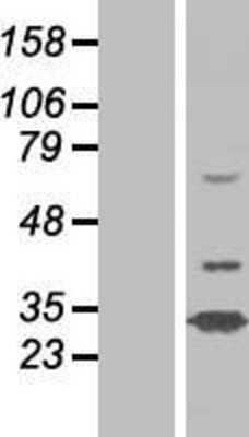 Western Blot: N4BP2L1 Overexpression Lysate [NBP2-05866]