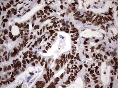 Immunohistochemistry: N4BP2L2 Antibody (OTI1C8) [NBP2-46078]