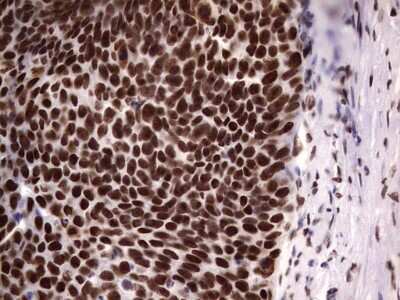 Immunohistochemistry: N4BP2L2 Antibody (OTI1C8) [NBP2-46078]