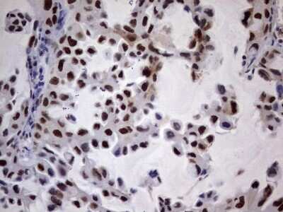 Immunohistochemistry: N4BP2L2 Antibody (OTI1C8) [NBP2-46078]