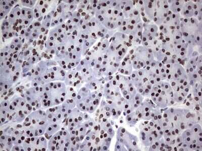 Immunohistochemistry: N4BP2L2 Antibody (OTI1C8) [NBP2-46078]