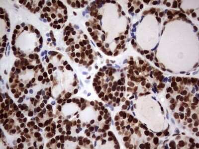Immunohistochemistry: N4BP2L2 Antibody (OTI1C8) [NBP2-46078]