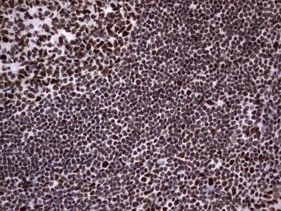 Immunohistochemistry: N4BP2L2 Antibody (OTI1C8) [NBP2-46078]