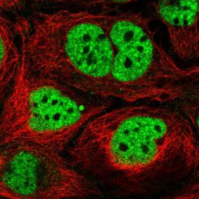 Immunocytochemistry/ Immunofluorescence: N4BP2L2 Antibody [NBP2-57235]