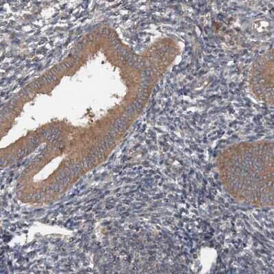 Immunohistochemistry-Paraffin: N4BP2L2 Antibody [NBP1-85674]