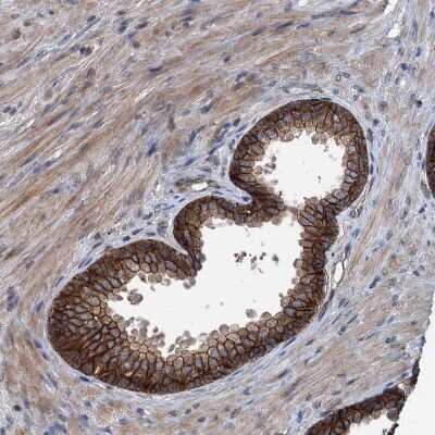 Immunohistochemistry-Paraffin: N4BP2L2 Antibody [NBP2-32624]