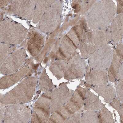 Immunohistochemistry-Paraffin: N4BP2L2 Antibody [NBP2-32624]