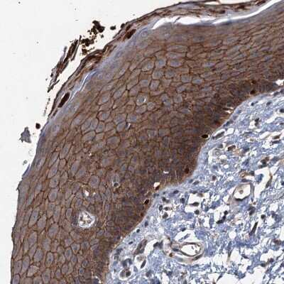 Immunohistochemistry-Paraffin: N4BP2L2 Antibody [NBP2-32624]