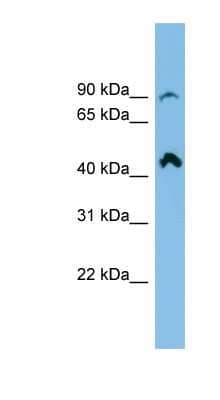 Western Blot: N4BP2L2 Antibody [NBP1-57762]