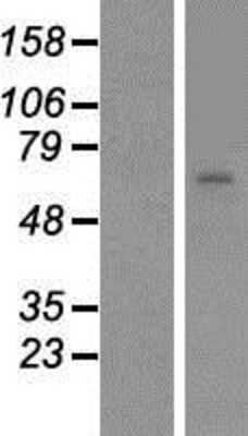 Western Blot: N4BP2L2 Overexpression Lysate [NBP2-07257]