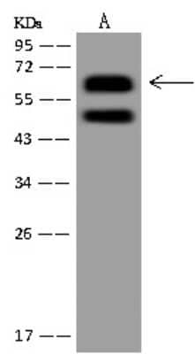 Western Blot: N4BP3 Antibody [NBP3-12669]