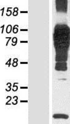 Western Blot: N4BP3 Overexpression Lysate [NBP2-07215]